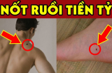 5 nốt ruồi Vàng thần Tài đánh dấu, sớm muộn cũng giàu