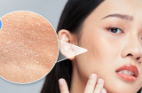 Cách để da căng bóng, mềm mịn, trời khô lạnh không lo nứt nẻ
