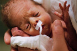 Rơi lệ với những hình ảnh của các bé sinh non