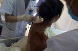 Bắt người chồng dội nồi nước lẩu đang sôi vào vợ và con gái