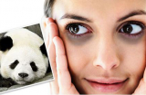 Loại bỏ quầng thâm, bọng mắt siêu đơn giản sau vài phút tại nhà, chị em thích mê vì hiệu quả bất ngờ