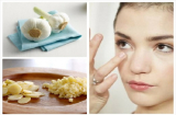 3 cách xóa bỏ mụn trứng cá trong tích tắc, phụ nữ nhất định phải biết để sở hữu Mừng SHBET phiên bản mới 2025 láng mịn