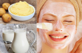 Chống lão hóa da đơn giản với khoai tây giúp bạn lưu giữ thanh xuân mãi ở tuổi 20