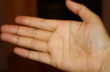Nốt ruồi son mọc ở đâu sẽ mang lại MAY MẮN, PHÚ QUÝ, HẠNH PHÚC cả đời cho chủ nhân