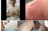 Hot: Bảo Duy khóc trong đau khổ tố bị Phi Thanh Vân đánh