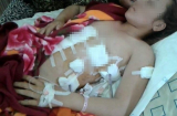 Đi đánh ghen bị người tình của chồng đâm 7 nhát