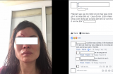 Phẫn nộ hình ảnh người phụ nữ bị chồng đánh chảy máu mũi