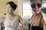 Sau 7 ngày 'đại dao kéo' Phi Thanh Vân đã diện váy bó để lộ hàng loạt vết thâm