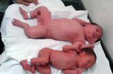Bé gái chào đời với cân nặng 5,7 kg khiến mẹ và các nhân viên y tế kinh ngạc