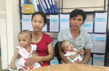 Shbet888.com link không chặn mới của hai bé gái song sinh dính liền phần dưới: Mẹ vui mừng vì các con đã... có mông