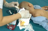 Thái Bình: Bé trai 3 tuổi bị xuất huyết não khi đi học ở trường mầm non