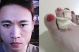 Tâm sự chua chát của người phụ nữ bị chồng có chồng cuồng ghen, quấn dây điện vào chân suýt ch.ết