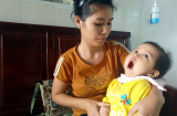 Xót thương bé gái 13 tháng tuổi teo não, mất nhận thức, tay chân co quắp chỉ vì một vết côn trùng cắn