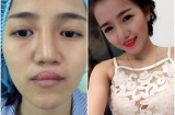 Cô gái sứt môi, hở hàm ếch thành hotgirl xinh đẹp khiến dân mạng phát sốt