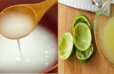 Da chết và mụn tự chui ra ầm ầm, hiệu quả gấp 10 lần kem lột da mặt chỉ trong 5 phút!