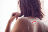 Tiết lộ 6 nốt ruồi MAY MẮN, TÀI LỘC ở lưng đừng bao giờ xóa bỏ