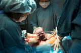 Đọc xong bài viết này còn người nào dám bảo SINH MỔ sướng hơn SINH THƯỜNG?