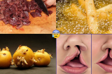 7 loại thực phẩm gây DỊ TẬT THAI NHI mẹ bầu phải biết