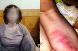 Điểm tin mới 10/12: Chủ cơ sở trông giữ trẻ nói gì khi phụ huynh bé gái 'tố' con mình bị bạo hành?