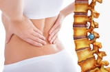 Nếu thường xuyên đau lưng ở vị trí này, rất có thể bạn đã mắc phải một loại ung thư