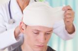 Những ai thường hay bị chấn thương sọ não?