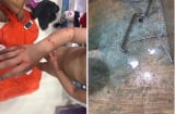Khi kính cường lực trở thành 'bom nổ chậm': Kính nhà tắm bỗng dưng phát nổ, bé trai bị thương tích khắp người