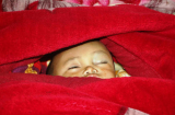 Thương cực thương: Bé trai 23 tháng tuổi bị rơi từ tầng 2 nhà sàn xuống đất, rạn hộp sọ, tụ máu não...