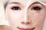 Đánh bay các vết nám da, da sáng bật tông trông thấy đừng bỏ qua những nguyên liệu tự nhiên này