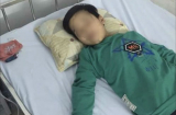 Bé trai bị đánh 'lên bờ xuống ruộng' vì bẻ trộm ngô: Bé bị chấn thương sọ não là không đúng