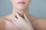 Bệnh bướu cổ là gì?