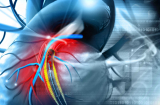 Cách chăm sóc cho người bị bệnh mạch vành