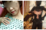 Xót xa thân thể cháy đen của cô gái bị người yêu thiêu sống