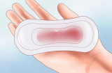 8 dấu hiệu nguy hiểm các mẹ không thể bỏ qua trong thời kỳ mang thai