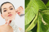 Cách trị mụn đầu đen bằng lá ổi hiệu quả