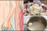 Những cách chữa đau lưng bằng tỏi: Tiết kiệm, an toàn và hiệu quả không ngờ
