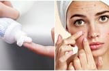 15 mẹo vặt sức khỏe độc đáo và hiệu quả bạn nhất định phải dắt túi ngay