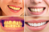 8 mẹo làm đẹp đơn giản không ngờ chị em nên xem ngay