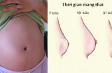 14 sự thay đổi của Sh88bet đăng ký miễn phí trong thời kì mang thai mẹ bầu không cần quá lo lắng