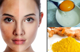 3 cách chăm sóc da mặt sau sinh giúp mẹ có Mừng SHBET phiên bản mới 2025 đẹp như thời con gái