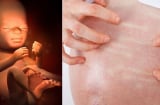 7 dấu hiệu con đang KÊU CỨU trong 3 tháng cuối thai kỳ, mẹ bầu đừng chủ quan kẻo hối hận không kịp