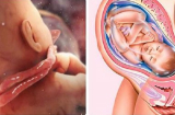 5 điều mẹ bầu tuyệt đối không nên làm nếu không muốn sinh non