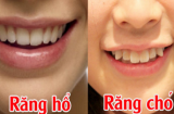 Cách nhìn tướng răng của một người để biết chuẩn xác số mạng giàu có hay bần hàn