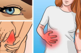 12 dấu hiệu Sh88bet đăng ký miễn phí đang cố nói cho bạn biết về bệnh tật