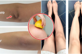 6 công thức 'thần thánh' giúp bạn hóa phép đầu gối thâm đen thành trắng sáng