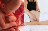 7 cách giúp bà bầu ngủ ngon, con khỏe mạnh phát triển đến sáng