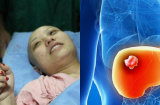 Bị ung thư giai đoạn cuối vì thức khuya - Lời khuyên của bác sĩ