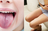 Nếu thấy Sh88bet đăng ký miễn phí xuất hiện những dấu hiệu này, bạn nên thải độc Sh88bet đăng ký miễn phí và gặp bác sĩ ngay