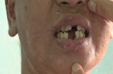 Thân thể, mặt mũi của cô gái bị biến dạng, chi chít sẹo, nghi bị chủ hành hạ?