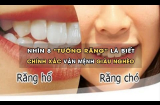 Tướng răng tiết lộ điều gì về người phụ nữ ?