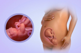 Thai nhi 34 tuần tuổi phát triển ra sao? Các mẹ cùng xem nhé